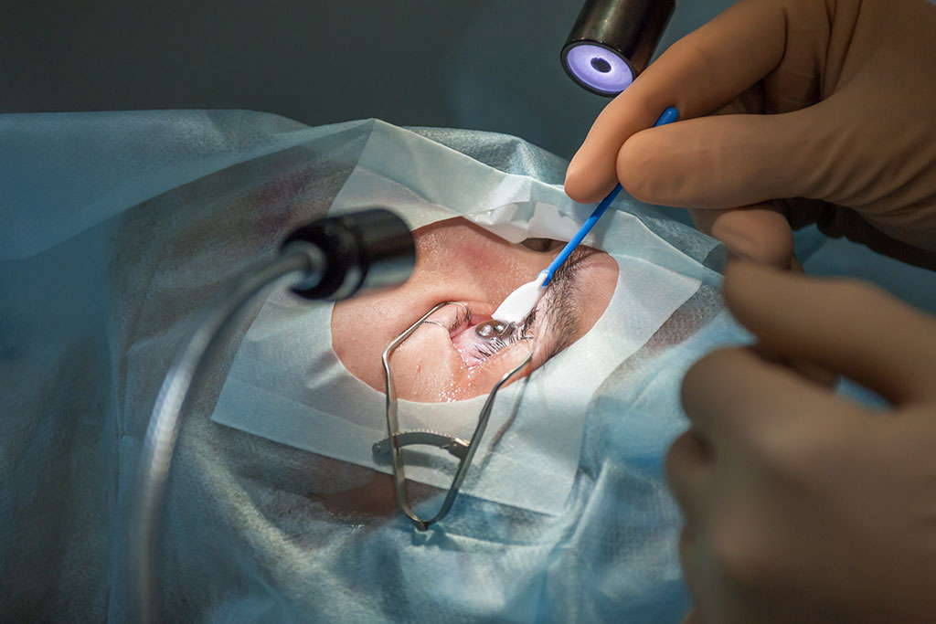 Lensvervangende chirurgie