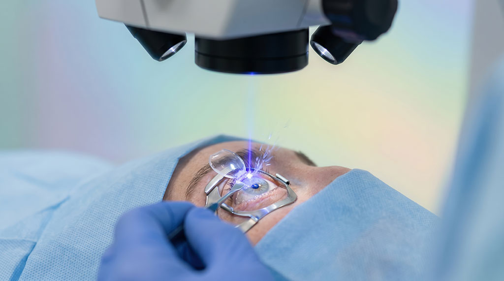 Refractieve laserchirurgie
