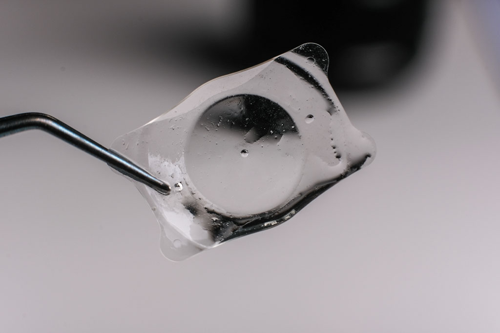Refractieve lenschirurgie